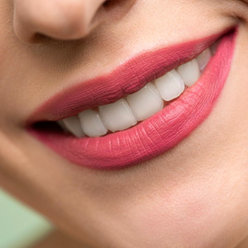 Estética dental